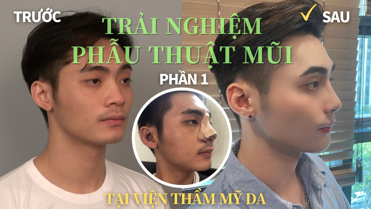 Viện thẩm mỹ DA: Hãy để Viện thẩm mỹ DA mang đến vẻ đẹp hoàn hảo cho bạn với những liệu trình làm đẹp tuyệt vời. Với đội ngũ chuyên viên tay nghề cao và thông tin chuyên môn phong phú, bạn sẽ có được sự cải thiện đáng kể cho làn da của mình. Hãy trải nghiệm dịch vụ chăm sóc da hoàn hảo với Viện thẩm mỹ DA ngay hôm nay!